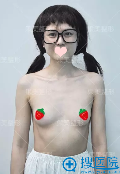 【丰胸日记】郑州集美赵亮隆胸案例 90后女孩花8800元从A升到C