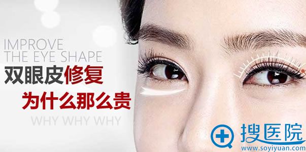 双眼皮修复手术为什么那么贵 双眼皮修复手术为什么那么贵
