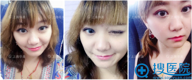 ����˫��Ƥ1���µ�ʱ����ĳ���Ȼ��