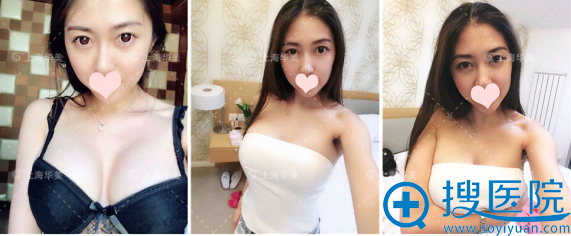 特贝茨隆胸术后7个月,请叫我性感女神 特贝茨隆胸术后7个月,请叫我性感女神