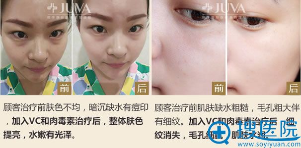 爱美者在<!--<i data=20240710 data-id=13204></i>-->做皮肤修复效果 爱美者在<!--<i data=20240710 data-id=13204></i>-->做皮肤修复效果