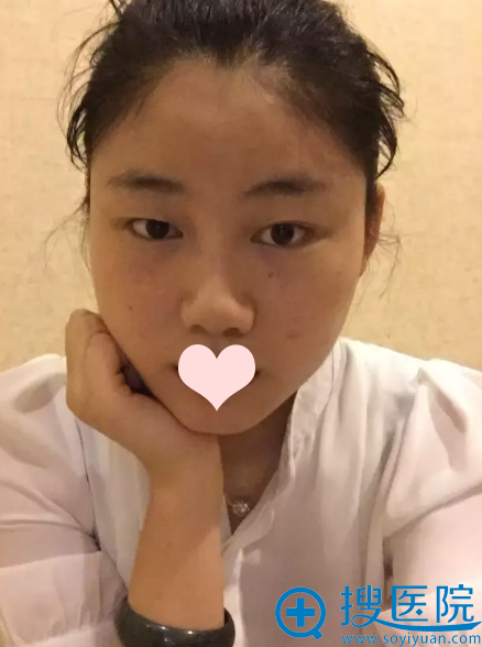 ˫��Ƥ��ǰ��