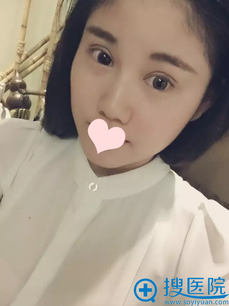 ˫��Ƥ����1����������