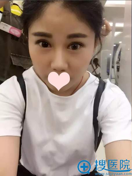 ˫��Ƥ����1�����µĻָ����