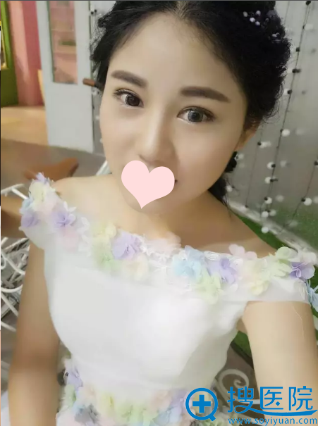 ˫��Ƥ�����º�������