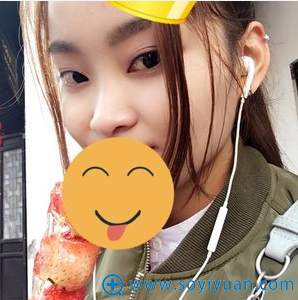 上海伊莱美邱文苑隆鼻案例 1.7万元让我轻松拥有精致小翘鼻