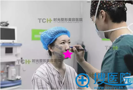 时光医生为佳佳姐做青春扣线雕设计 时光医生为佳佳姐做青春扣线雕设计