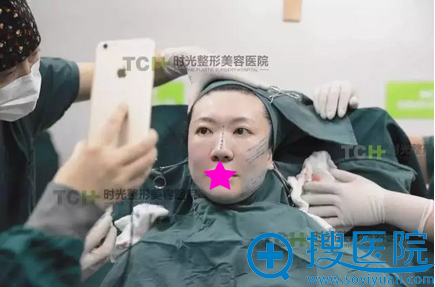 青春扣埋线完成半边脸,对比提升明显 青春扣埋线完成半边脸,对比提升明显