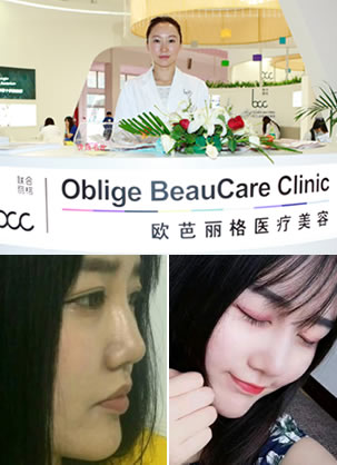 北京欧芭丽格假体隆鼻和耳软骨垫鼻尖手术让我蜕变获得新生