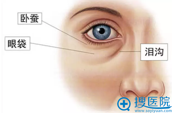 眼袋、卧蚕、泪沟的位置 眼袋、卧蚕、泪沟的位置
