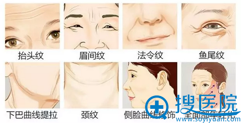 �ߵ���Խ�����沿����