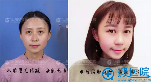 华美半纹眉多少钱 上海华美韩式半纹眉1800元起附案例