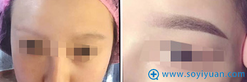 <!--<i data=20240710 data-id=12374></i>-->整形美容医院韩式半纹眉案例 <!--<i data=20240710 data-id=12374></i>-->整形美容医院韩式半纹眉案例