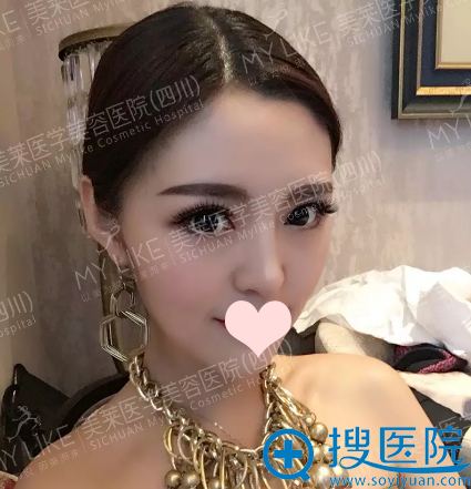 【亲身经历】在成都美莱找夏秋做线雕15天后 前男友哭着求复合