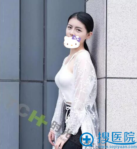 北京王明利隆胸医生真人整形案例过程 脂肪填充后与性感同在!