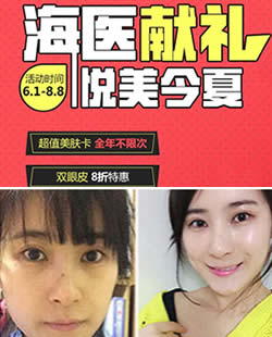北京海医悦美8月整形优惠价格表 常冬青自体脂肪填充8800元