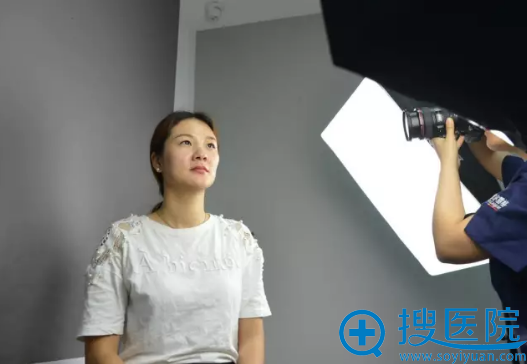 线雕提升术前照片 线雕提升术前照片