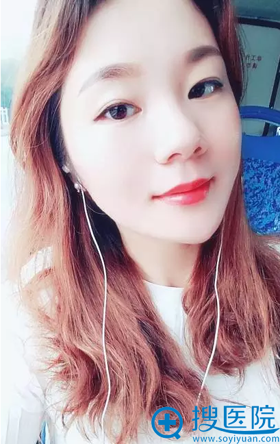 线雕提升15天后变回少女 线雕提升15天后变回少女