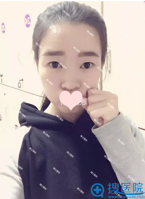 ˫��Ƥ��ǰ��