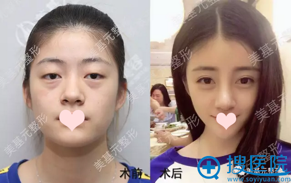 �人����Ԫ��˫��Ƥ���� ��������˫��Ƥ+¡��������ʵ�ָ�Ч��