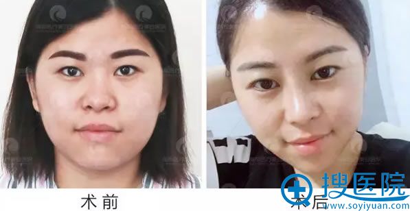 ���ٶ����ۺ����������10��ָ�Ч��ͼ