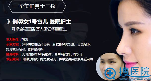 南宁华美整形鼻综合手术案例 南宁华美整形鼻综合手术案例