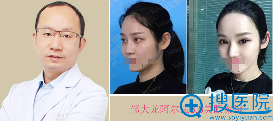 重庆当代邹大龙阿尔法美眼案例 重庆当代邹大龙阿尔法美眼案例