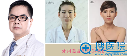 重庆当代牙祖蒙晶钻逆龄案例 重庆当代牙祖蒙晶钻逆龄案例