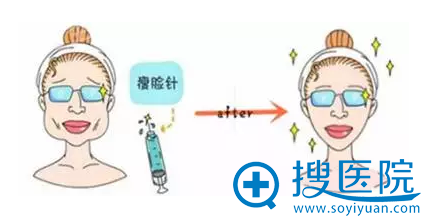 前后对比图 前后对比图