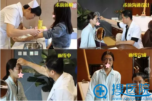 石家庄蓝山杜建龙面部自体脂肪填充+鼻综合术前准备 石家庄蓝山杜建龙面部自体脂肪填充+鼻综合术前准备