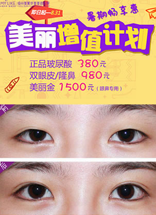 福州华美割双眼皮好吗?2017暑期美丽活动双眼皮价格980元
