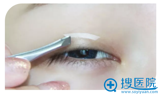 双眼皮贴 双眼皮贴