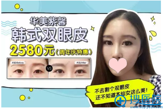 <!--<i data=20240710 data-id=13402></i>-->韩式双眼皮2580元 <!--<i data=20240710 data-id=13402></i>-->韩式双眼皮2580元