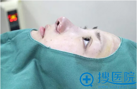 【亲身经历】武汉美立方胡江伟鼻综合修复案例 韩范美女诞生记