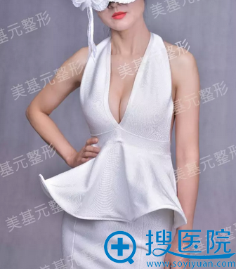 假体隆胸术后写真 假体隆胸术后写真