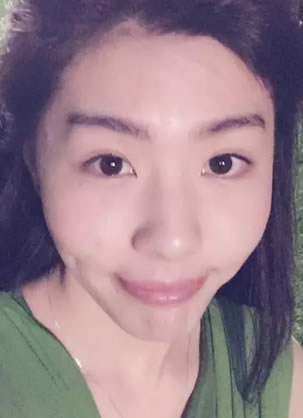 玻尿酸填充全脸多少钱 北京欧华8月1400元+顾客真人案例