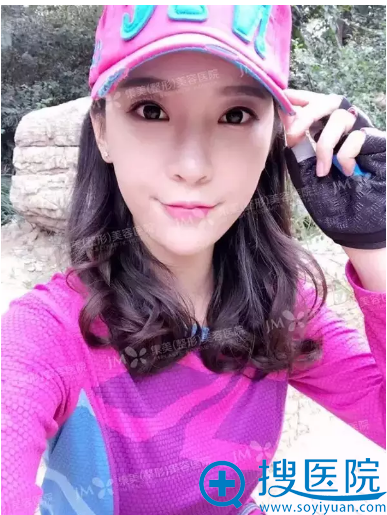 我经过朋友介绍选择郑州集美整形医院赵亮做了250cc假体隆胸