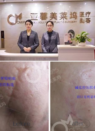 �����ĸ�ҽԺ���ư̺��޸��� ��ܰ������̺ۿư��㸧ƽ����