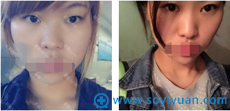 �Ͼ�ά�������п�˫��Ƥ+�����ǹ轺¡����ǰ