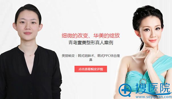 青岛壹美谭拯主任隆鼻案例 青岛壹美谭拯主任隆鼻案例