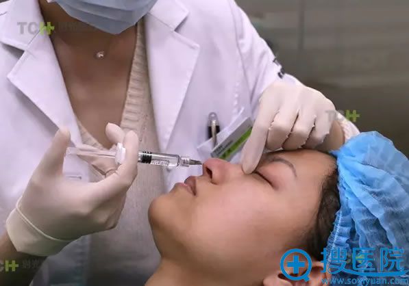 玻尿酸隆鼻手术过程图 玻尿酸隆鼻手术过程图