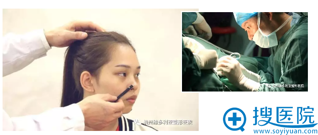 刘中策院长术前设计中 刘中策院长术前设计中