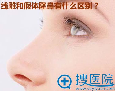 线雕隆鼻和假体隆鼻有什么区别 线雕隆鼻和假体隆鼻有什么区别