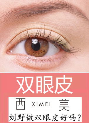 北京西美医院刘野做双眼皮好吗?价格是多少钱?