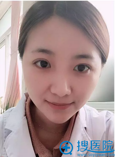 双眼皮术后天效果 双眼皮术后天效果