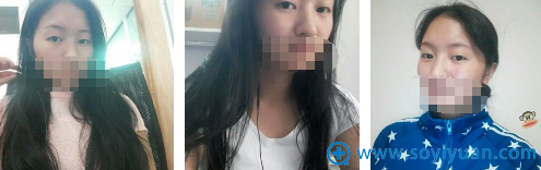 ���ں���ҽԺѦ����˫��Ƥ��ǰ��