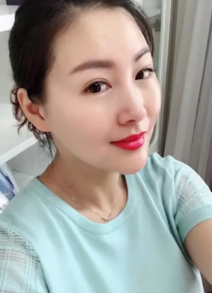 乔亚登玻尿酸怎么样?天津美莱员工体验后让35岁的她年轻10岁