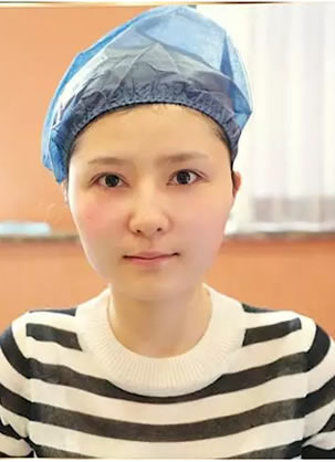 皇室绢丝效果好吗?武汉艺星真人案例30分钟即刻减龄10岁