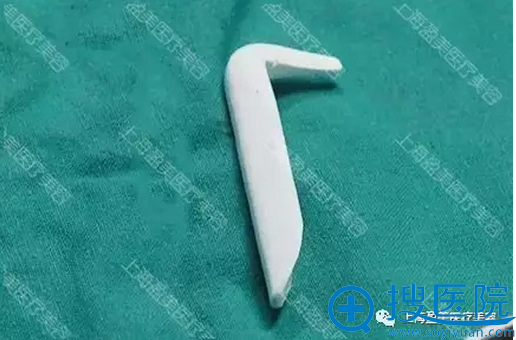 隆鼻假体 隆鼻假体