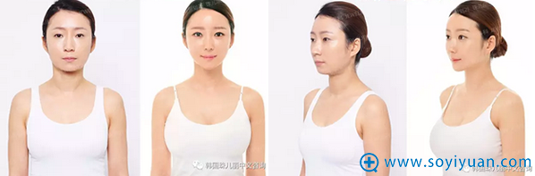 辣妈在韩国珠儿丽整形的转变 辣妈在韩国珠儿丽整形的转变